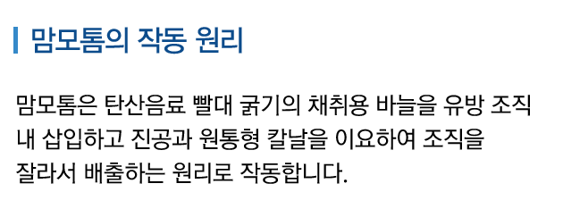 맘모톰의 작동 원리