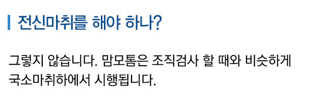 전신마취를 해야 하나?